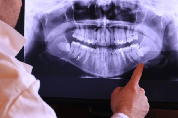 Best Emergency Root Canal Treatment in Alpena, MI